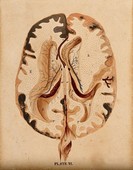 Similar image